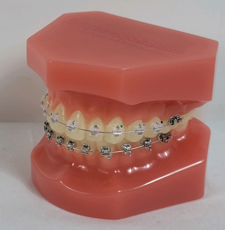 New - Dental Orthodontic Teeth Model with Metal Braces , Oral Demonstrating Models for Dentist & Students .