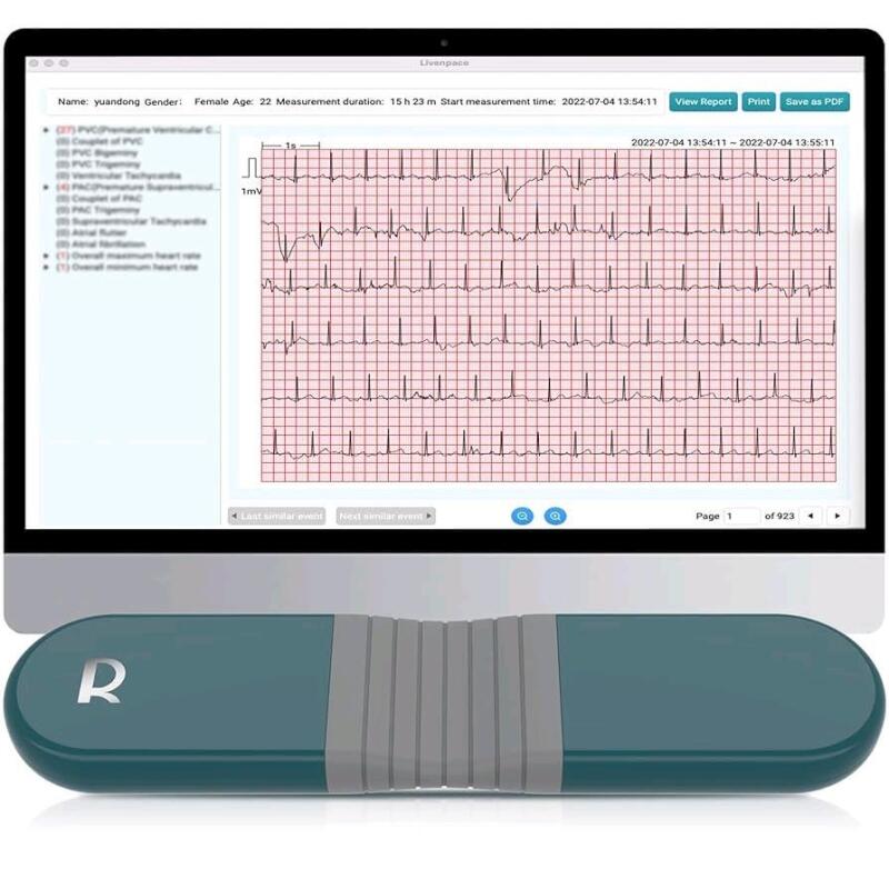 WOW!! New LIVENPACE AI Heart Monitor, 24 Hours Chest Lead Device with Free AI Analysis & PC Report, Chargeable Recorder, HHM1 | Retails Over $600!!!