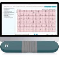 WOW!! New LIVENPACE AI Heart Monitor, 24 Hours Chest Lead Device with Free AI Analysis & PC Report, Chargeable Recorder, HHM1 | Retails Over $600!!!